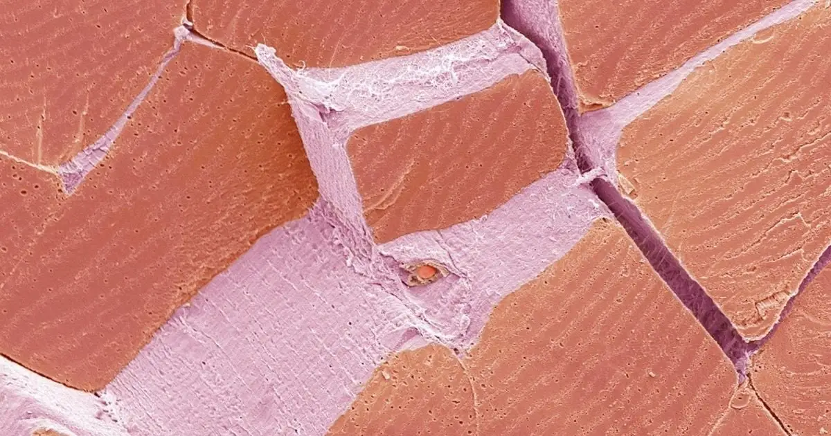 Test Your Eyes: What Is This Week's Microscope Mystery?
