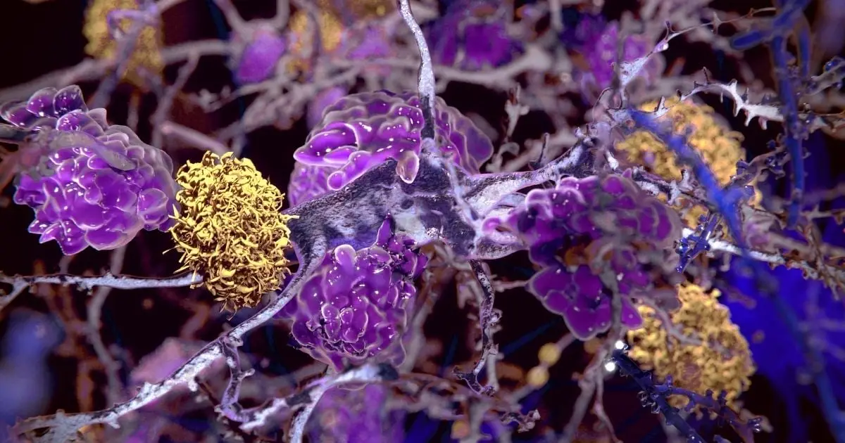A Human-Safe Drug Reduces Multiple Signs of Alzheimer's in Mice