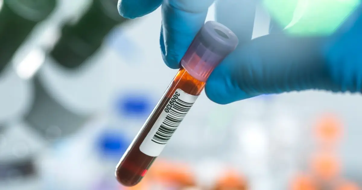Scientists Identify a Hormone Spike Linked to Anorexia Nervosa