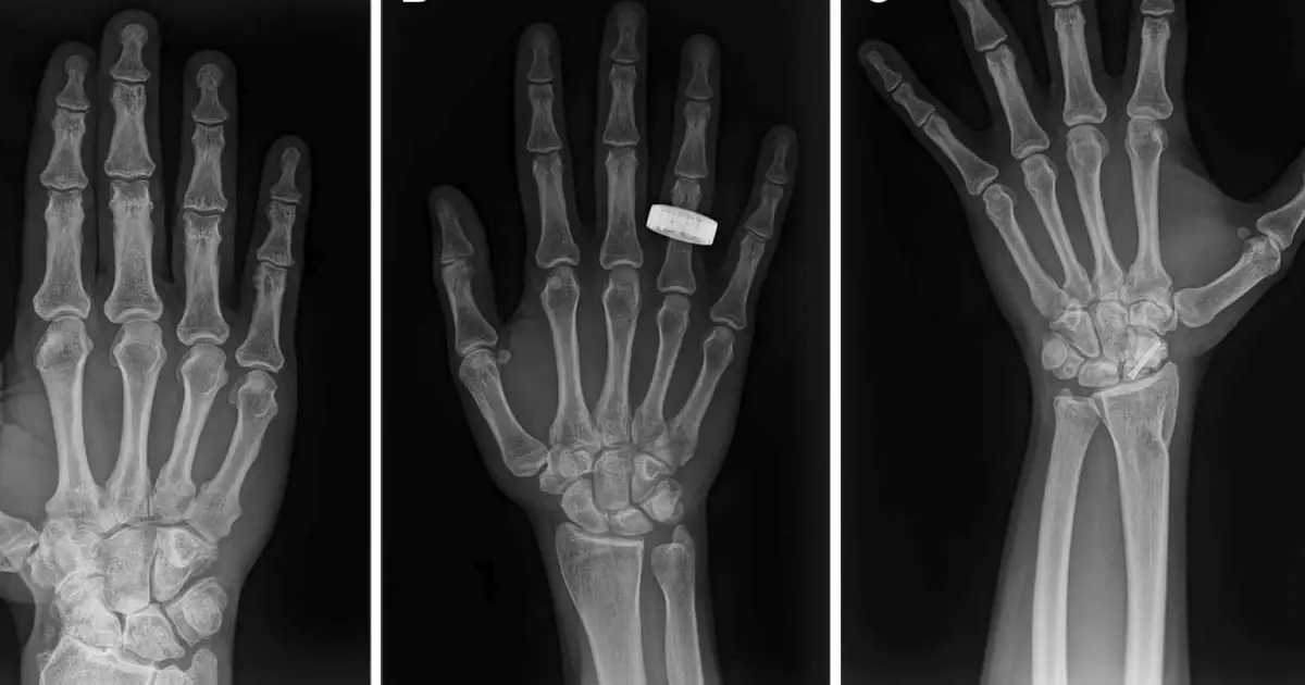 Astronauts Have Taken The First Human X‑Rays in Space, And They Actually Worked