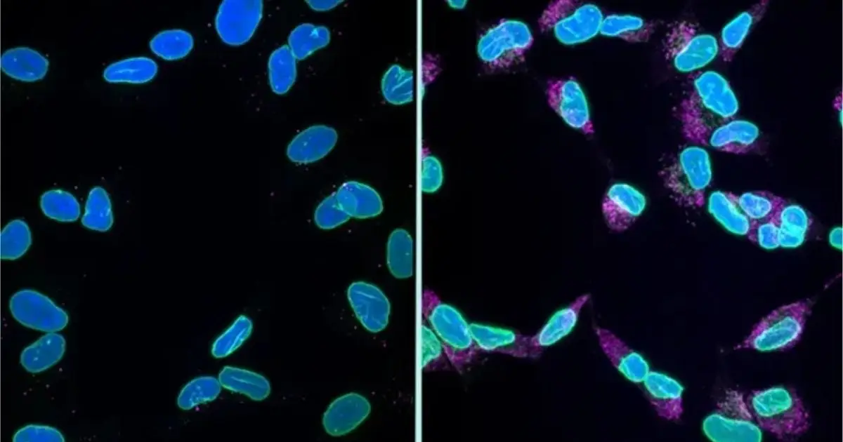 Scientists Think They've Finally Figure Out How Alzheimer's Kills Brain Cells