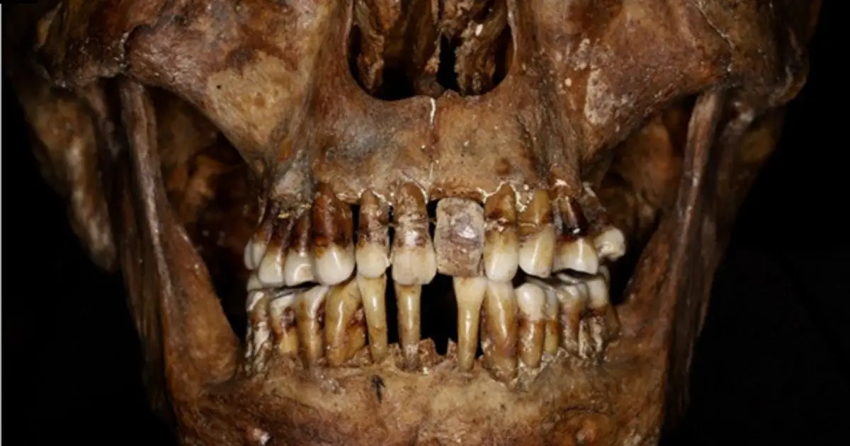 This 17th-Century Aristocrat Had an Ingenious Secret For Keeping Her Teeth
