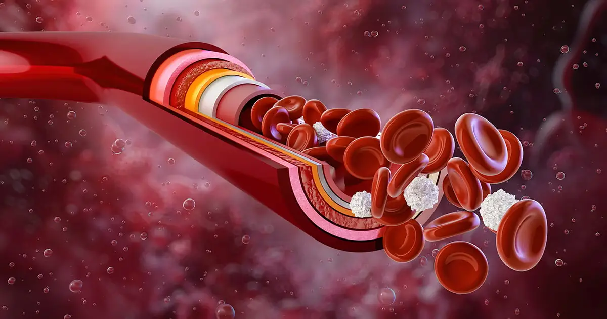 A Third Hidden Driver of High Blood Pressure Has Been Discovered – And a Potential Fix