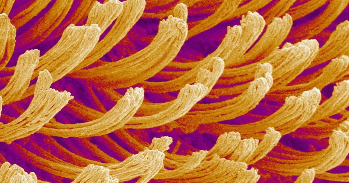 What The Heck Are We Looking at? This Week's Monday Microscope Mystery