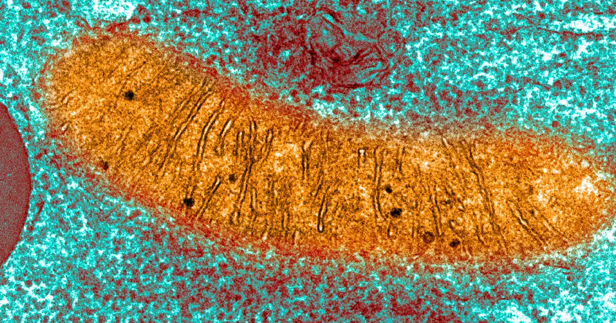Abnormal New Structure Detected in The Brains Of Humans And Mice With Alzheimer's Disease