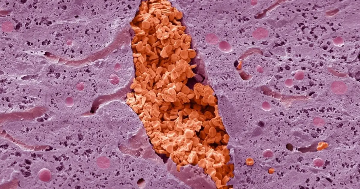 Monday's Microscope Mystery: What Is This Pink And Red Oddity?