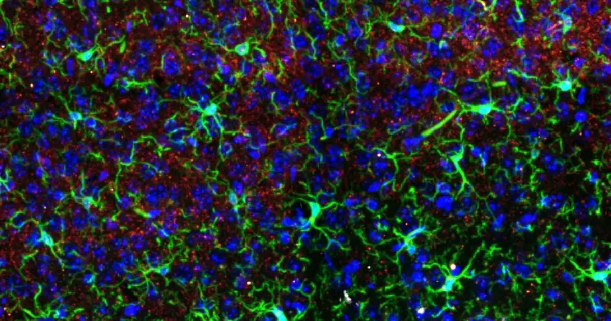 Ketamine Alters Brain Structures – But Only in One Sex, Study in Mice Finds