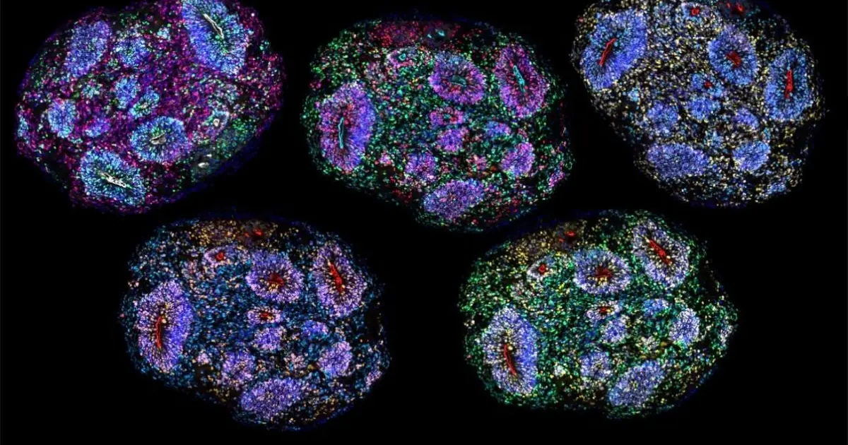 Unprecedented: Scientists Have Built Miniature Brains That Experience The Passage Of Time