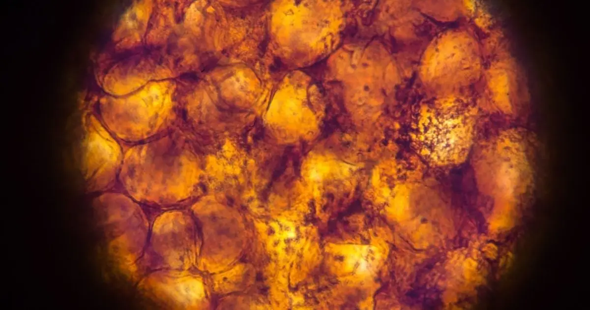 Our Fat Tissue May 'Remember' Obesity, Even After We've Lost Weight