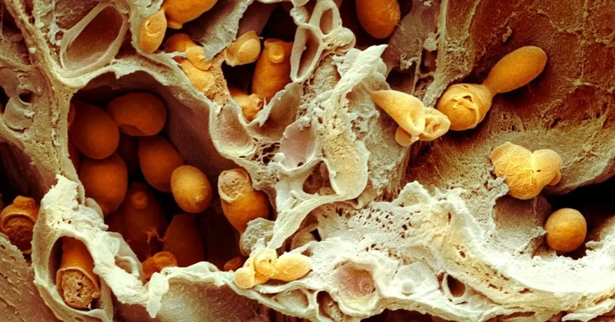 Deadly, Drug-Resistant Fungal Infections Are Spreading – Scientists Just Discovered a Potential Treatment