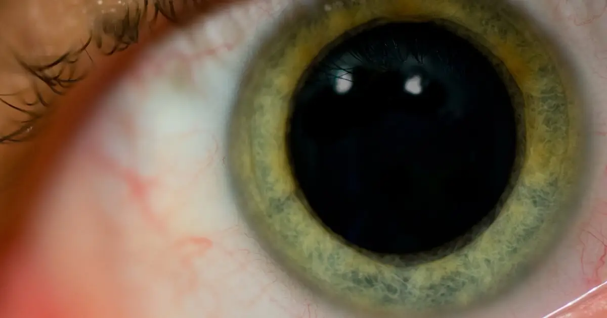 Scientists Reveal The Strange Neurological Reason Your Pupils Dilate When You're Surprised
