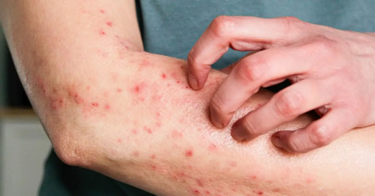 Paying Attention to Your Body Could Actually Change Your Immune Response