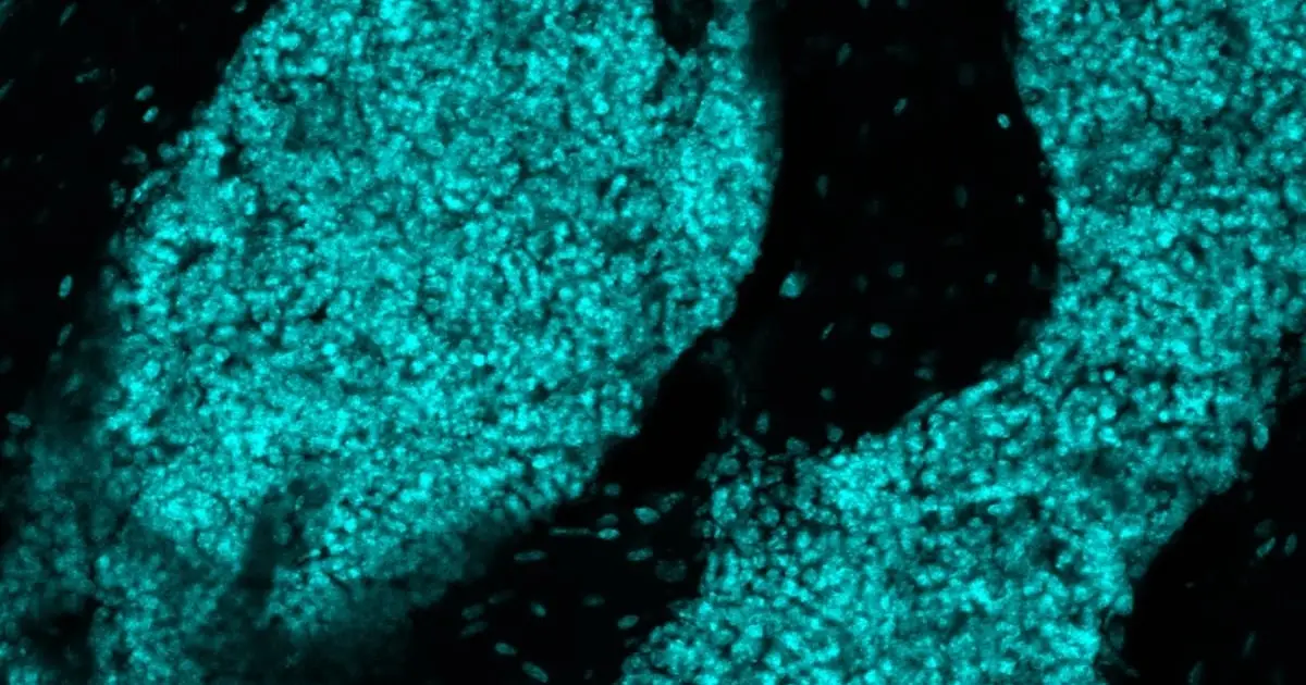 Scientists Discover a New Organ Hiding in The Skull