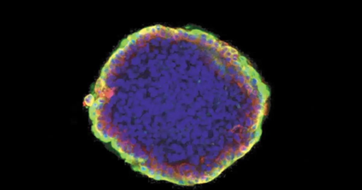 Scientists Discover a Cannabis Receptor That Could Stop Breast Cancer Spreading