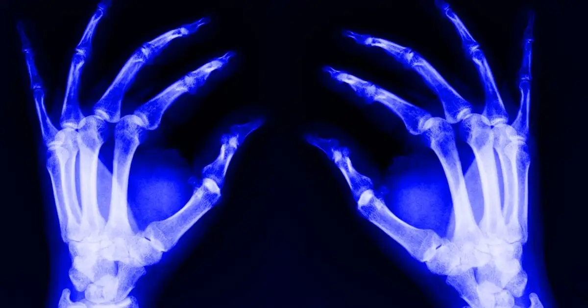 A Hidden Cause of Aging May Spread From Deep Inside Your Bones