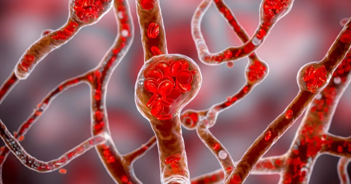 Scientists Might Have Found a New Cause of High Blood Pressure, And a Way to Treat It
