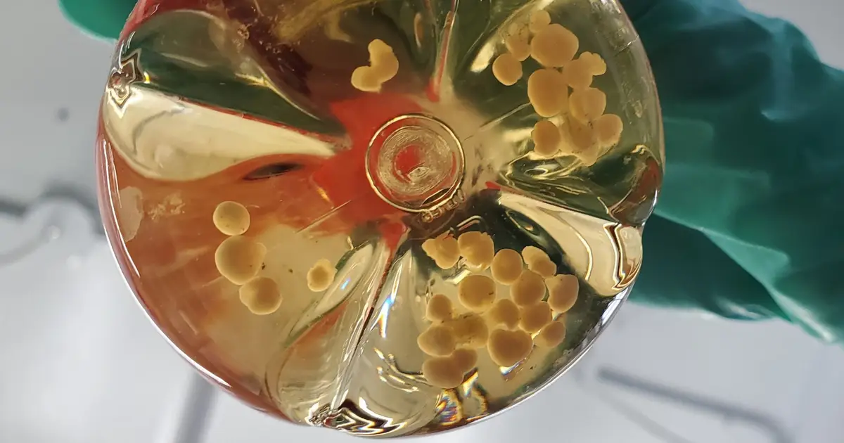 Scientists Connected 3 Human Mini-Brains in a Dish. They Learned Something The Others Couldn't.