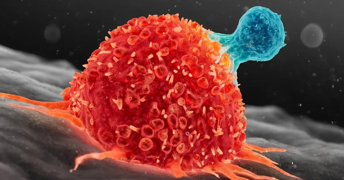 A 3-Year-Old's Metastatic Cancer Disappeared After Two Doses of Experimental Therapy