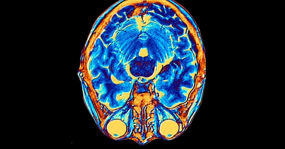 Textbook Rewrite: The Human Brain Has Two Distinct Origins, Scientists Discover
