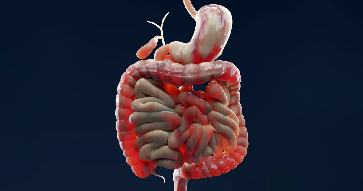 Why Does IBD Keep Flaring Up? Scientists Found a Clue in The Gut Lining