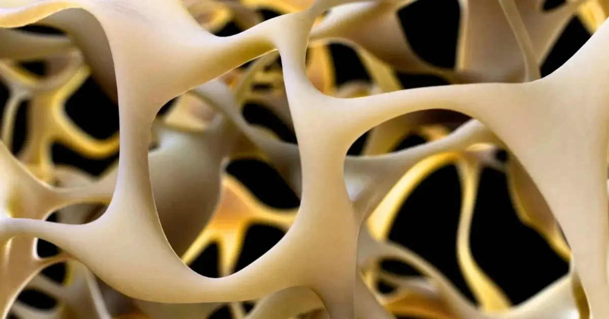 High Blood Pressure May Directly Accelerate Osteoarthritis