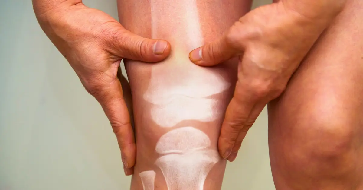 Weaker Bones Have Been Linked to Faster Brain Aging in a New Study