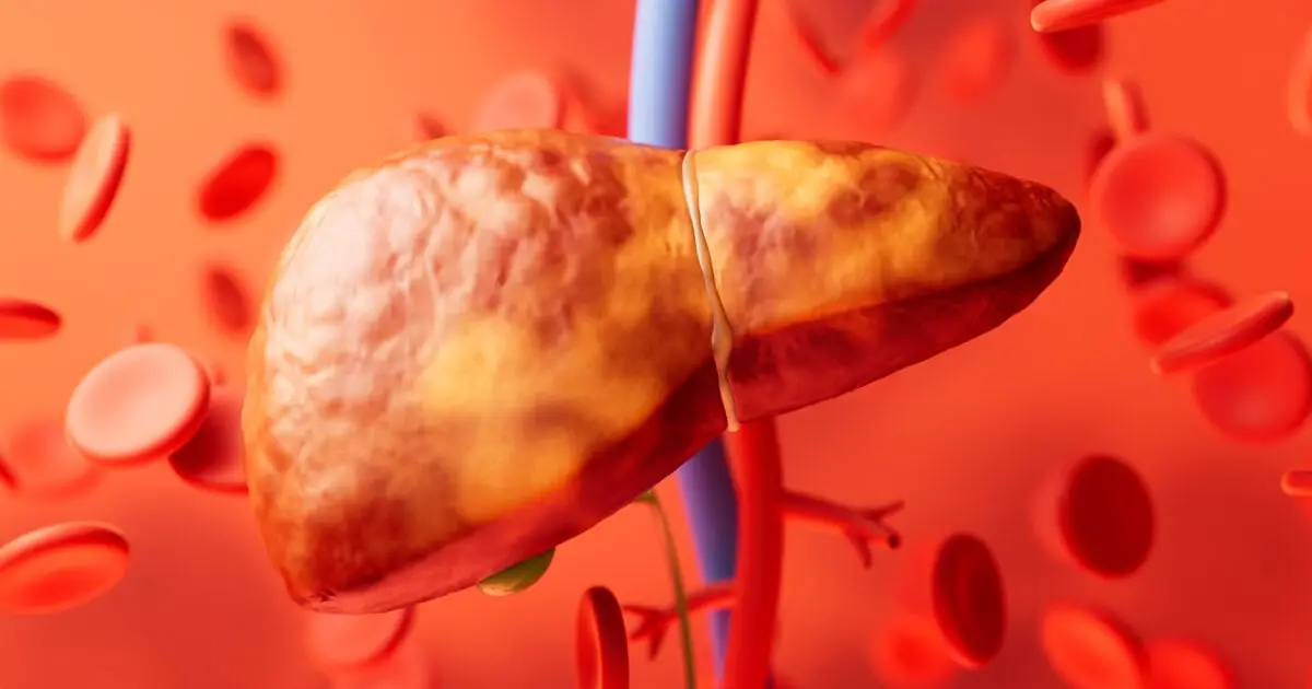 Common Liver Disease May Actually Have 5 Distinct Types With Different Health Risks