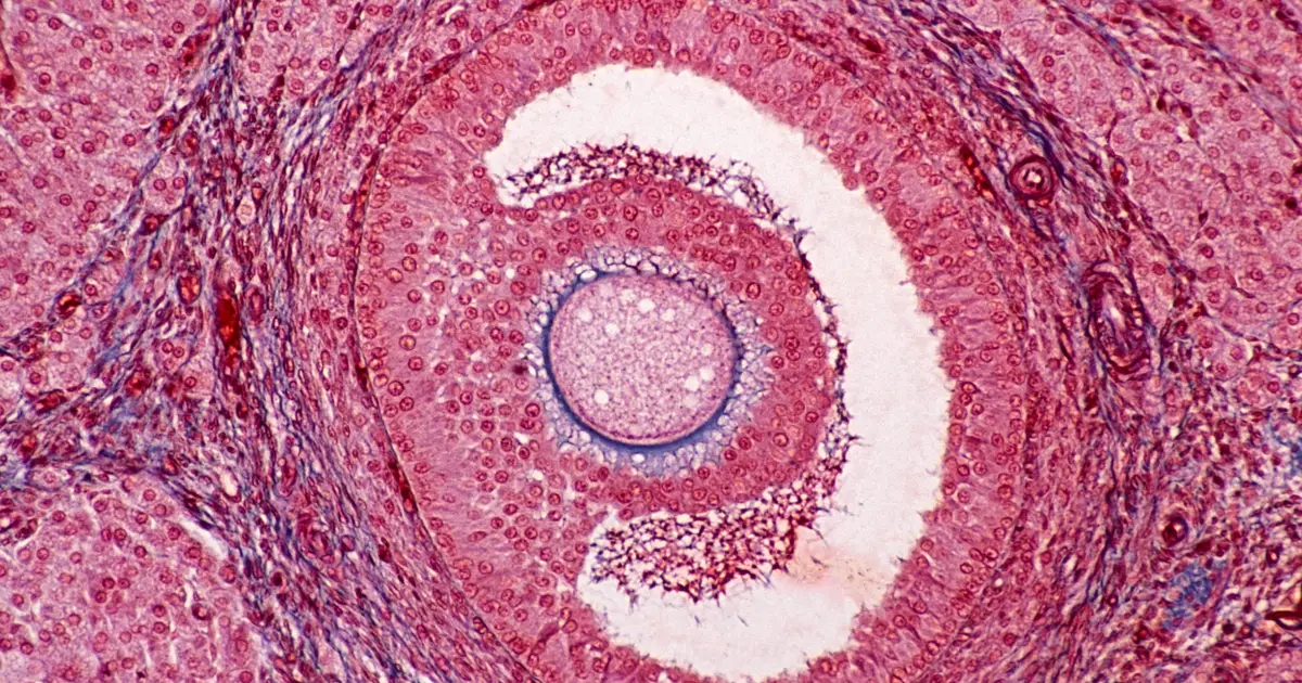 Mounting Evidence Shows a Common Plastic Chemical Can Affect Human Ovaries