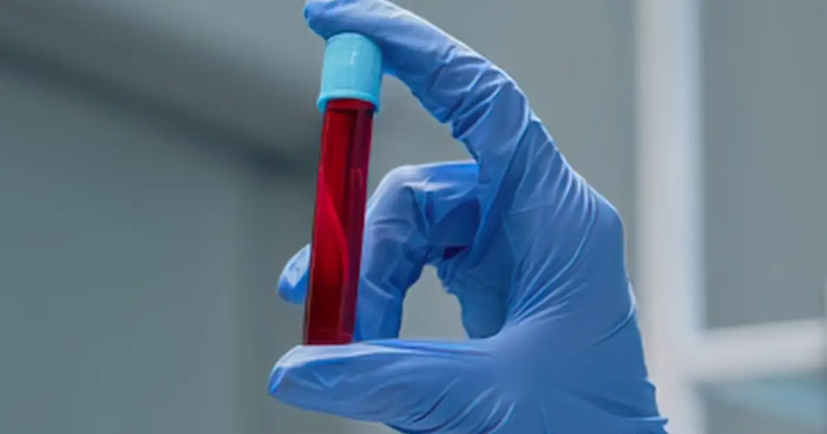 We May Have Been Wrong About Fasting Before Blood Tests, Study Reveals