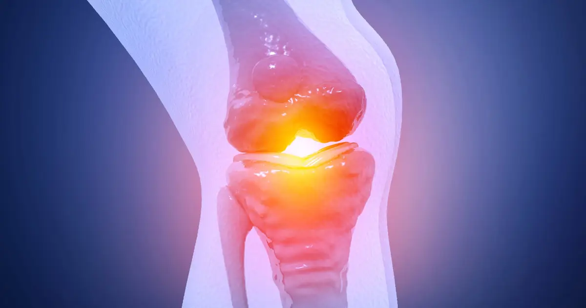 FDA-Approved Drug Could Be Repurposed to Relieve Osteoarthritis Pain And Protect Cartilage