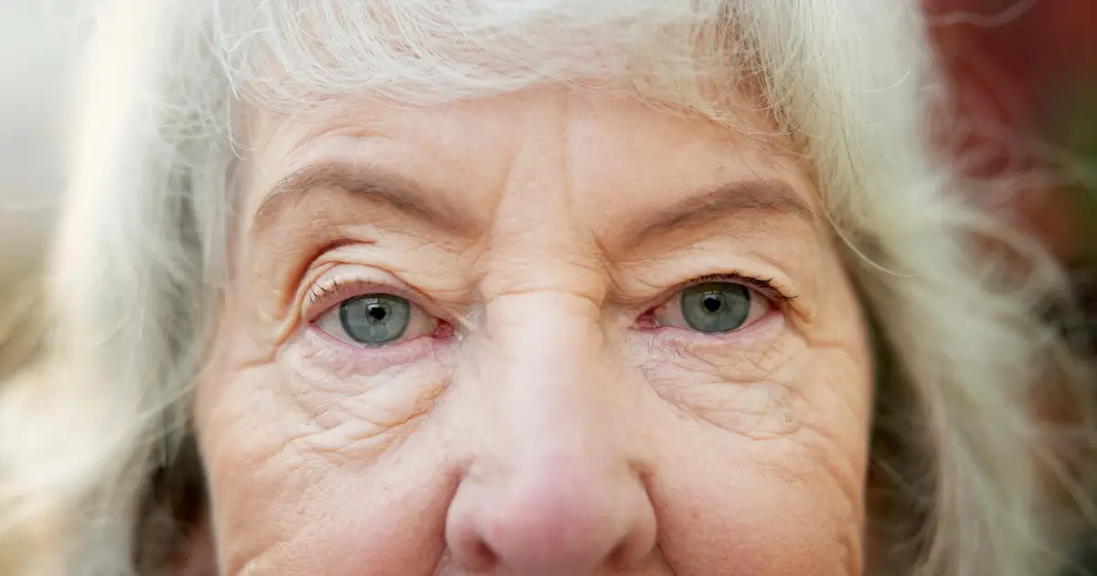 LASIK Alternative Promises to Improve Vision Without Scalpel or Lasers