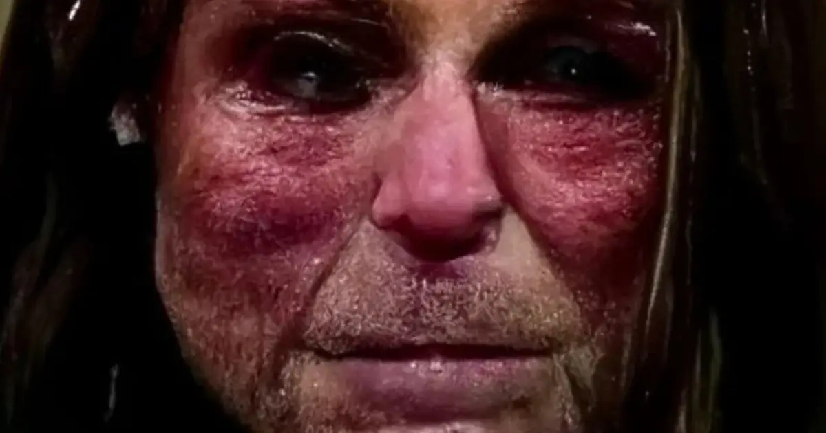 The Eerie True Story of The Nightmare Face Haunting The Internet
