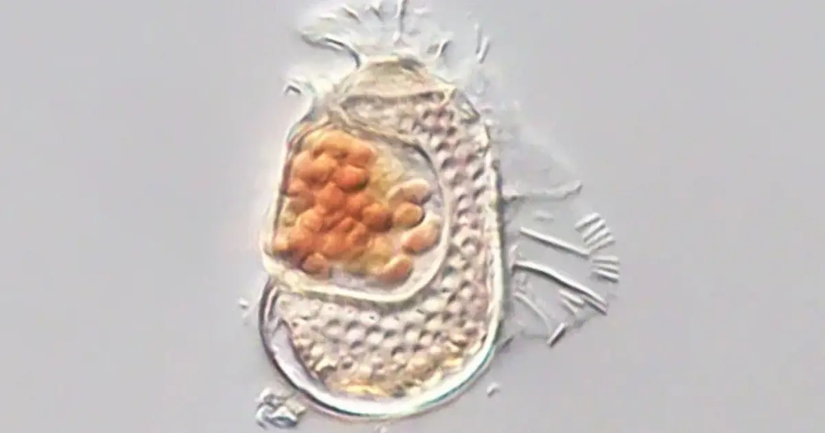 Microbe Discovered With One of The Smallest Genomes on Record, Pushing The Bounds of What It Means to Be Alive