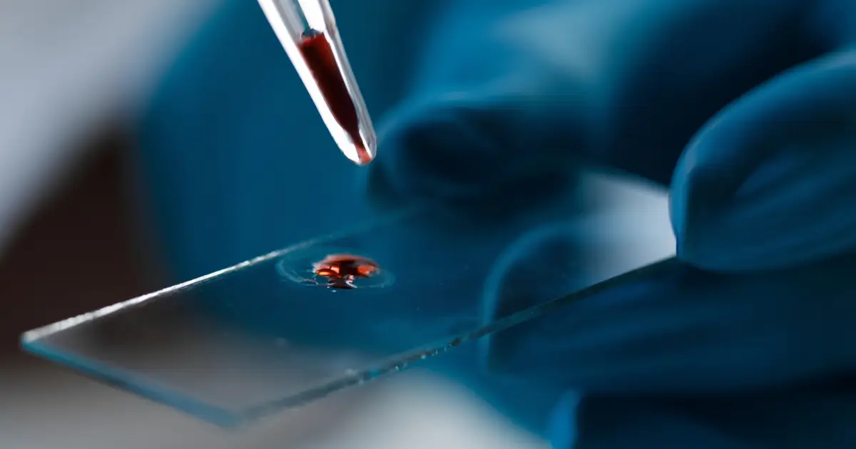 Researchers Developed a Molecule to Fight Alzheimer's – Then Found It's Already in Our Blood