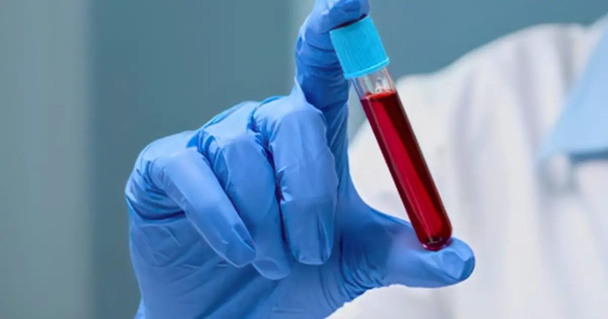 Scientists Found a Blood Signature Linked to 23% Lower Risk of Death