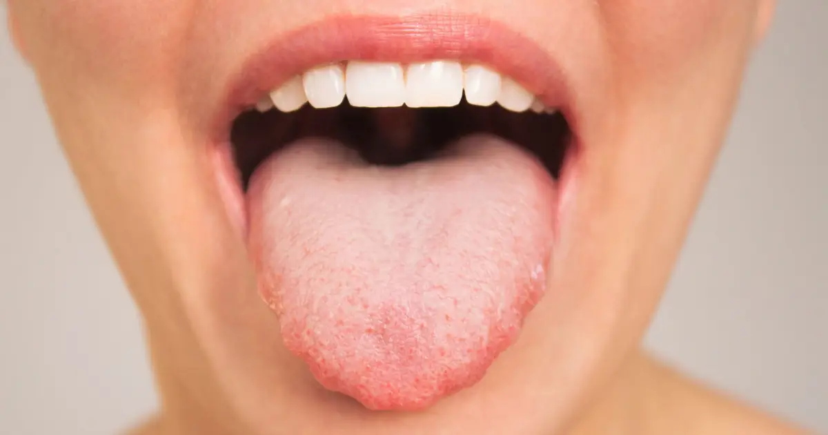Your Mouth's Bacteria May Be Linked to How Quickly You Think