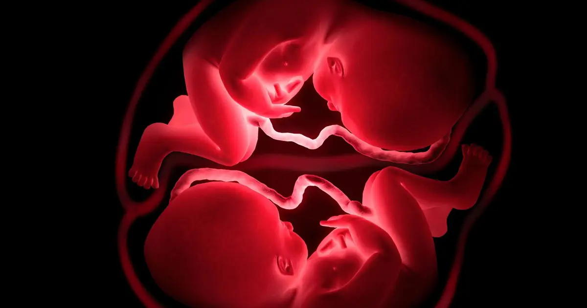Scientists Trace How Cancer Passed Between Twins Before Birth