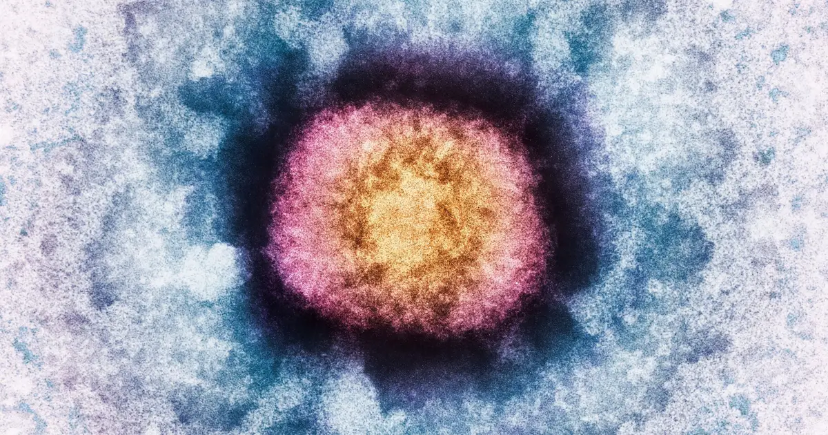 DNA From a Human Brain Gene Has Turned Up In a Virus