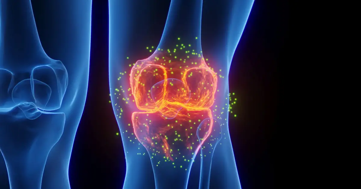 Stanford scientists found a way to regrow cartilage and stop arthritis