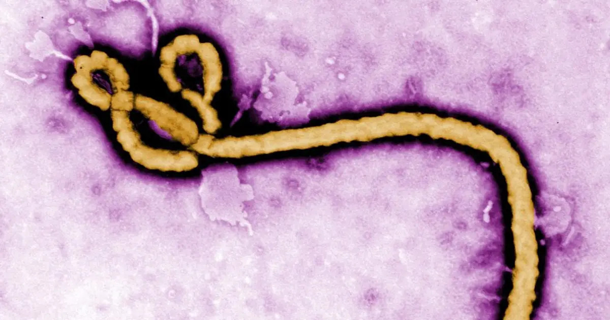 The latest developments on Ebola, hepatitis B, long Covid