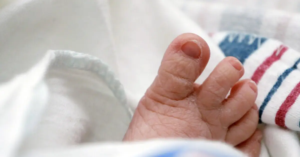The U.S. infant mortality rate fell to an all-time low, though it still trails other similar nations