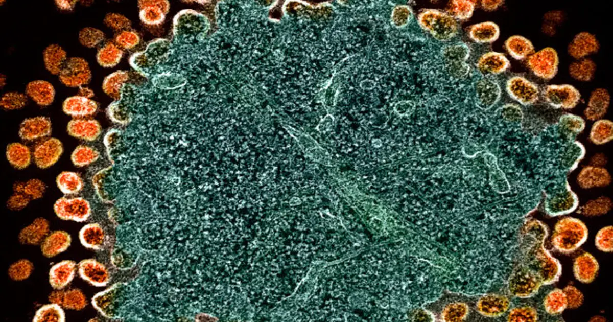 Scientists uncover a new hiding spot for HIV