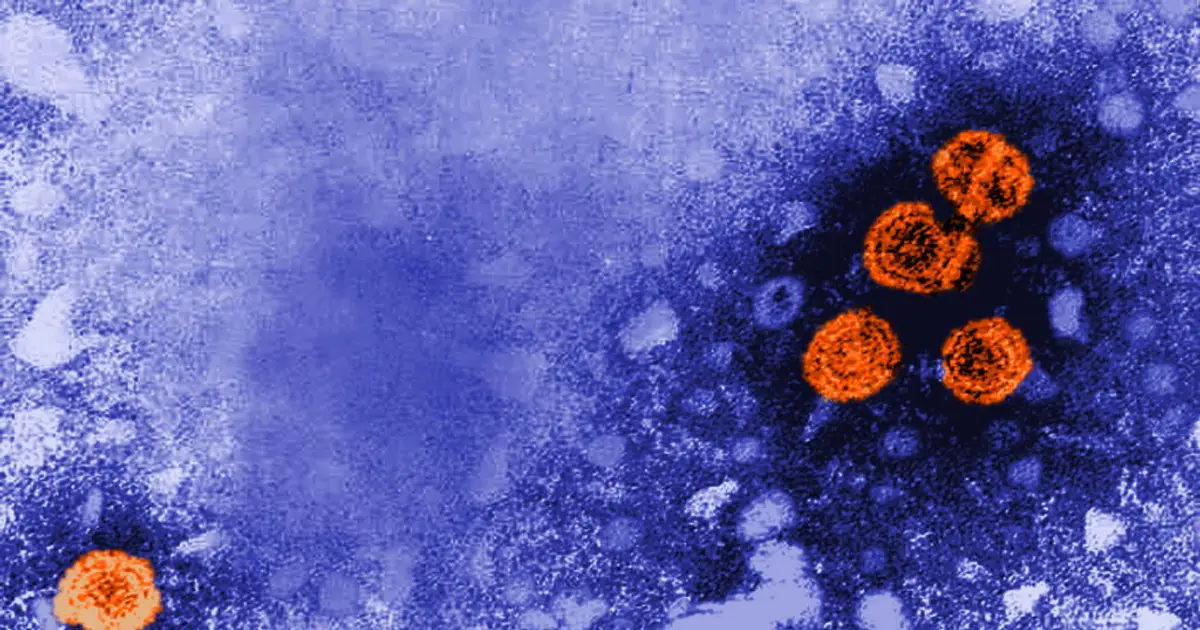 STAT+: Experimental hepatitis B treatment was a ‘functional cure’ for nearly 1 in 5, new data show
