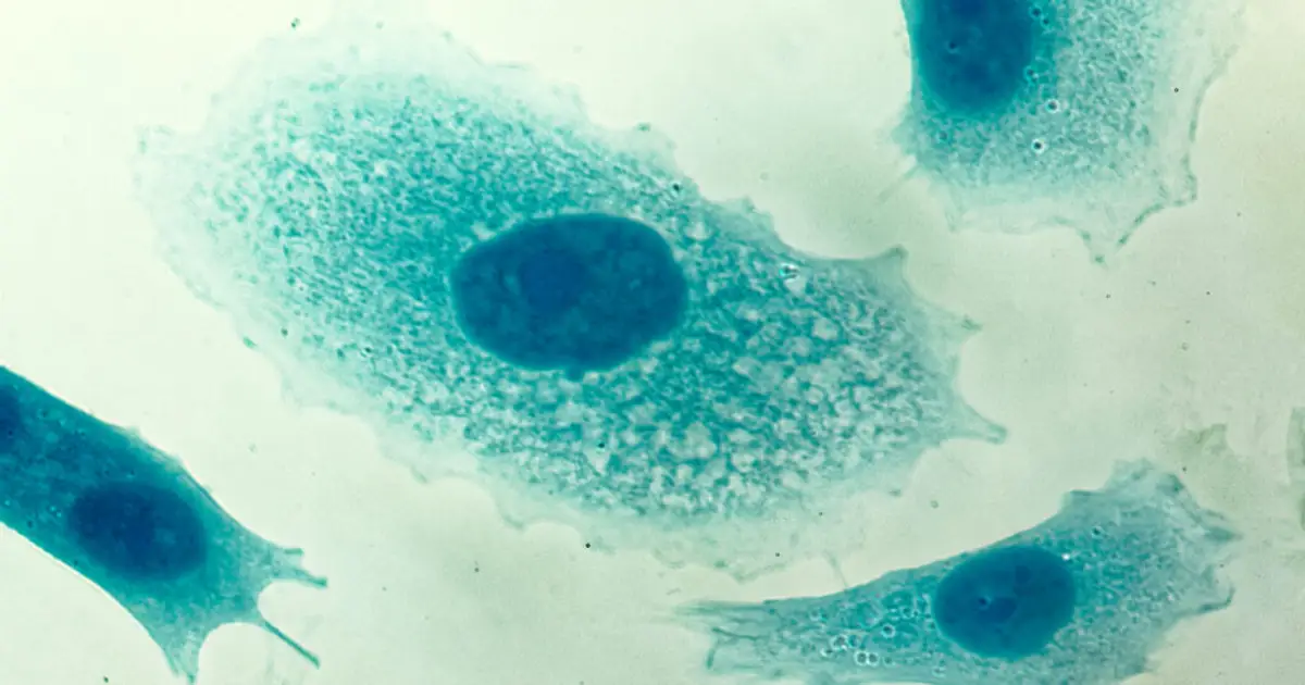 PSA screening for prostate cancer reduces disease-specific deaths, new review shows
