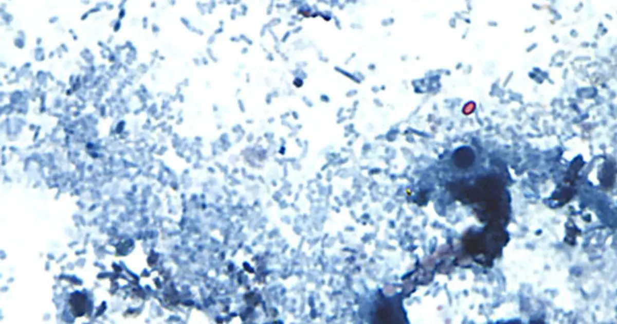A new, separate outbreak of the diarrhea-causing parasite