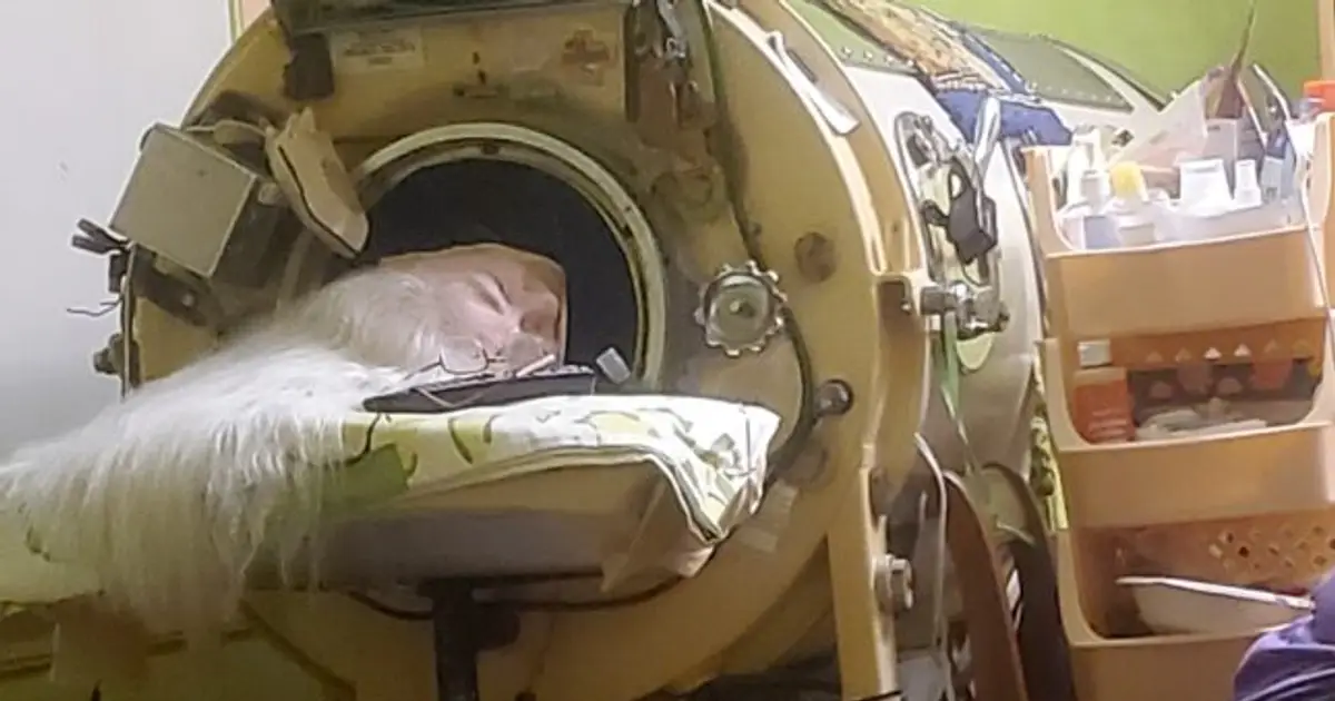 Martha Lillard, last U.S. polio patient using iron lung, dies at 78 in Oklahoma