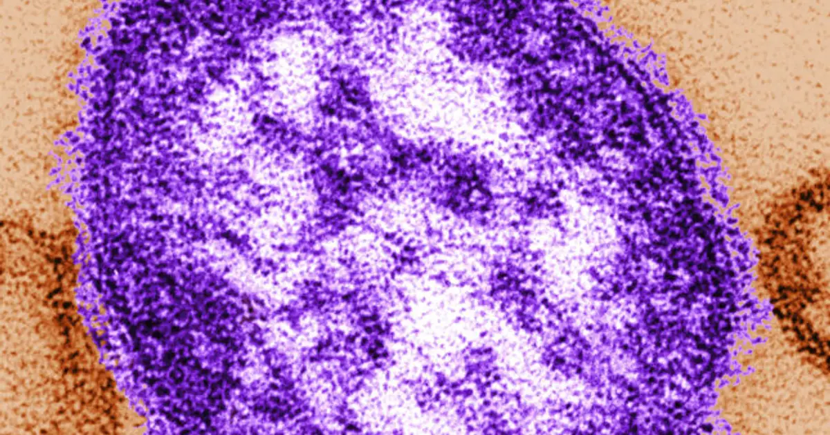 Coroner releases details of infants who died amid growing Pennsylvania measles outbreak